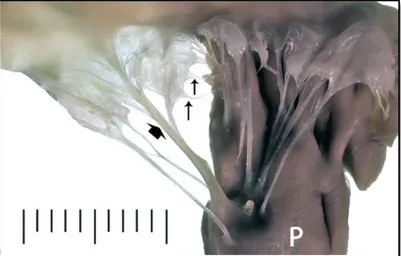 Figure  2:  Dorsolateral  view  of  a  normal  mitral  valve  apparatus  from  two-year-old  mongrel  dog  (Reproduced with permission from Dr