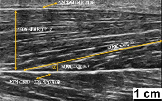 Figure  1.  Identification  of  the  three  main  outcomes  derived  from  the  skeletal  muscle  architecture  assessment,  from  a  sonogram  taken  at  the   mid-distance  of  the  femur  length,  in  the  back  of  the  thigh,  and  capturing the bicep