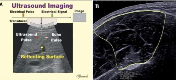 Figure 4. (A) Schematic representation of the mechanism underlying the sonographic  measurement