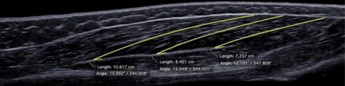 Figure  5.  Sonogram  obtained  from  the   BFlh  using  ultrasonography.  Right  side  corresponds to the distal component of BFlh