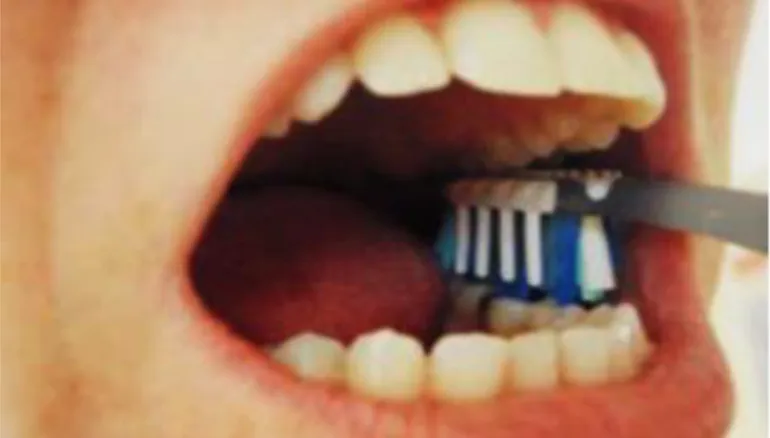 Fig. 7 Escova dentária como Mouth Prop (NDH - NHST, 2014) 
