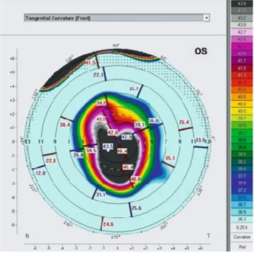 Figura 9- Cone Oval(retirado: (1)). 