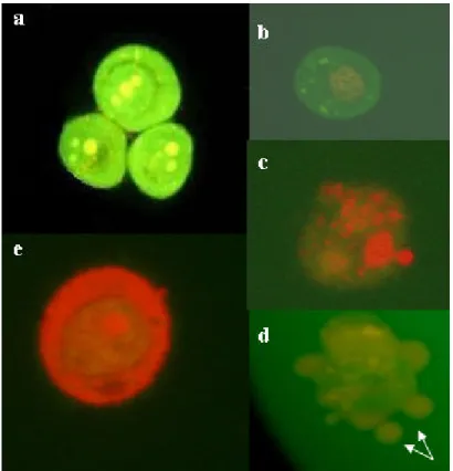 Figura 2 . Análise em microscopia de fluorescência de células HSG classificadas em padrões  pré-estabelecidos: (a) célula viável; (b), (c) e (d) células em apoptose; (e) célula em necrose
