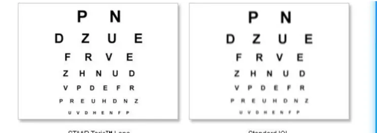 Foto 14 – Comparação de Acuidades visuais 