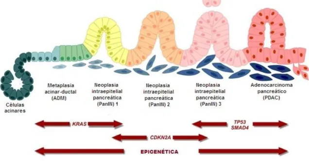 Figura  2.  O  adenocarcinoma  ductal  pancreático  origina-se  nas  células  do  epitélio  pancreático  ductal