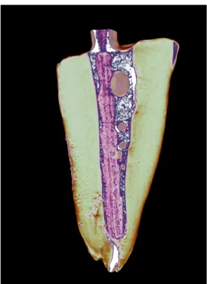 Figura 7  - Imagem de raiz reconstruída por meio do software CTvox 
