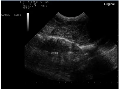 Figura 3 – Ecografia uterina em que se visualizou o complexo HQE-piómetra.  