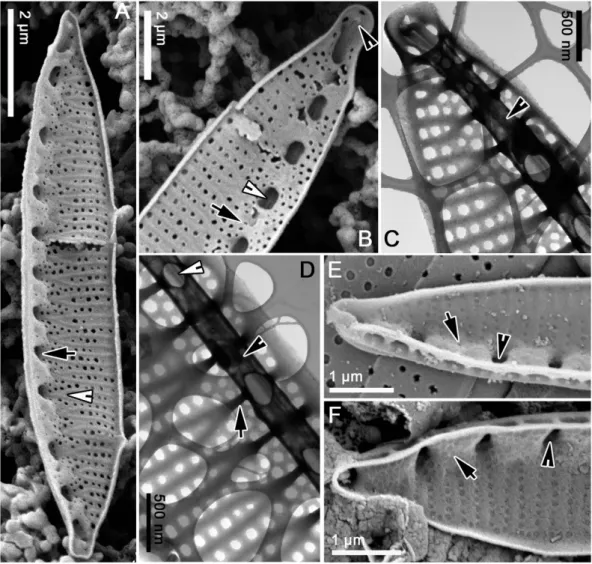 Figure 3.  Simonsenia spp. in EM. (A–D) Simonsenia aveniformis. (A) S. aveniformis internal view of the  whole specimen, note the internal openings of the portulae =  alar canals (arrow) and the place where the  two transapical ribs are formed (arrowhead)