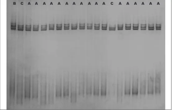 Figure 3. SSCP analysis at exons 10-11 of the as 1 -casein gene in Charnequeira goat breed (20 animals)