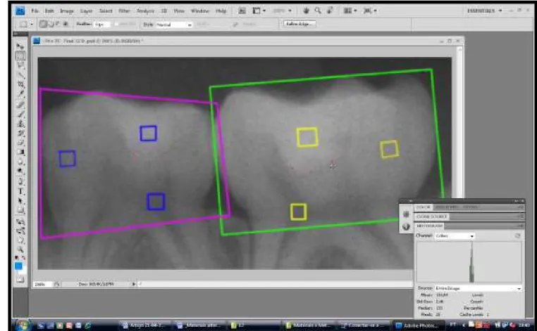 Figura 3 – Programa Adobe Photoshop com desenho esquemático das áreas delimitadas  para  analisar  as  radiografias  interproximais,  mostrando  as  regiões  de  dentina  afetada,  dentina  hígida,  restauração  e  polpa,  além  da  ferramenta  histograma 