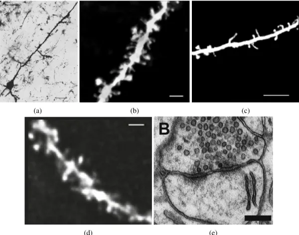 Figure 2.1: Neuronal images collected by different microscopy techniques - a) widefield mi- mi-croscopy (scale bar: 25 µ m) [28]; b) confocal microscopy (scale bar: 2 µ m) [29]; c) two-photon microscopy (scale bar: 10 µ m) [24]; d) micro-endoscopy microsco