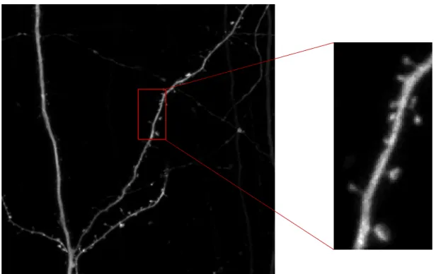 Figure 3.3: Maximum intensity projection of a) - the median filtered stack; b) – a slice of the median filtered stack.