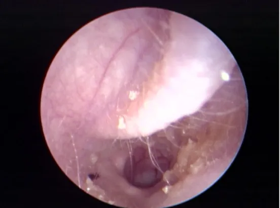 Figure  6  –  Normal  ear  canal  of  a  rabbit;  note  the  minimal  ear  wax  (bottom  right)