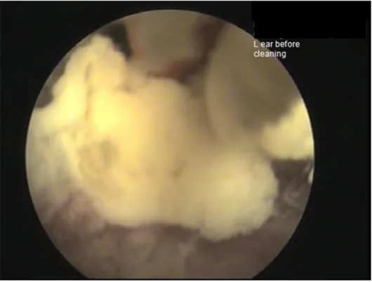 Figure  7  –  Ear  canal  of  a  rabbit  with  otitis  externa  with  accumulation  of  purulent material within the canal (photo courtesy of Dr