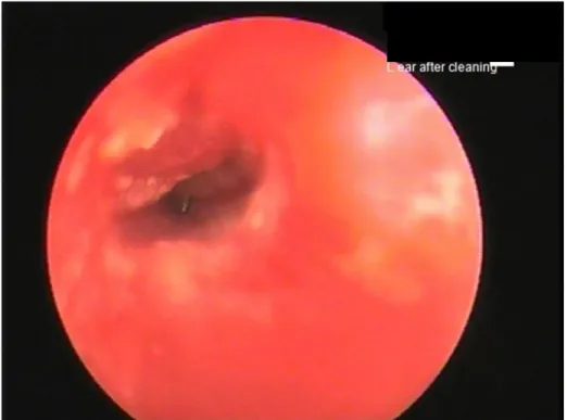 Figure  8  –  Ear  canal  of  a  rabbit  with  otitis  externa;  note  the  swelling  and  irritation  of  the  ear  canal  secondary  to  aggressive  flushing  and  cleaning  (photo courtesy of Dr