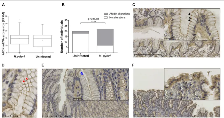 FIGURE 6 | H. pylori infection affects the expression and localization of the Afadin protein in the human gastric mucosa