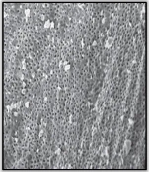 Figura 4 - Túbulos dentinários cobertos de  smear  layer  (Adapatado  de  Syed  et  al.,  2013)