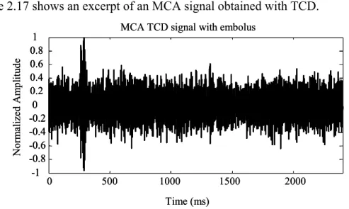 Figure 2.17 shows an excerpt of an MCA signal obtained with TCD.  Normalized Amplitude 0 500 1000 1500 2000-1-0.8-0.6-0.4-0.200.20.40.60.81 Time (ms)