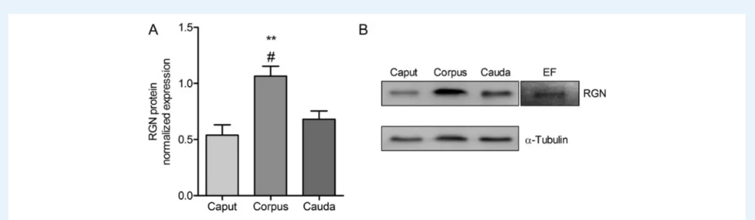 Figure 7 FRAP value ( m M antioxidant potential/mg tissue) in the epi- epi-didymis of Tg-RGN rats versus Wt