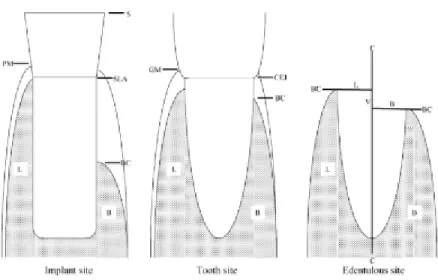 Figure 2: representation of different points of measure (Araujo, 2005) 