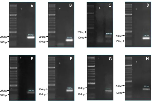 Figura 6 – Eletroforese em gel de agarose 1.5% corado com GreenSafe dos produtos de PCR do cDNA dos genes  apoptóticos em estudo