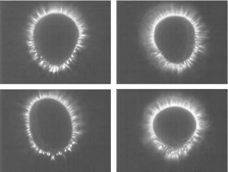 Figure  1:  GDV-grams  (gas  discharge  visualization  camera  photos  of  the  light  emission patterns) from the two middle fingers of patient with Parkinson’s disease,  before and after qigong