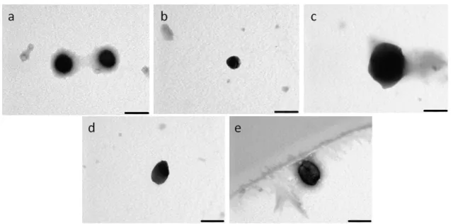 Figure  9-  A  analysis  by  transmission  electron  microscopy  of  PDMAEMA:DNA  polyplexes  at  different  ratios:  5(a),  7.5(b),  10(c),  12.5(d)  and  20(e)