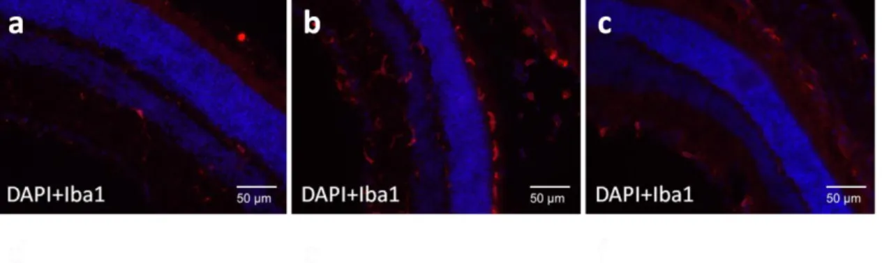 Figure  20-  Immunohistochemistry  for Iba1,  a  marker  of  active  microglia. (a) Non- Non-injected eye (b) PDMAEMA Non-injected eye; (c) Sham Non-injected eye