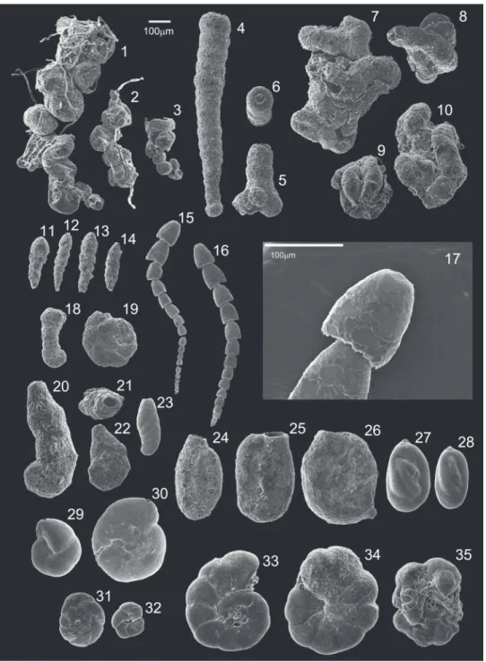 FIGURE 2. Scanning electron micrographs of the foraminifera specimens. Scale bar equals 100 µm
