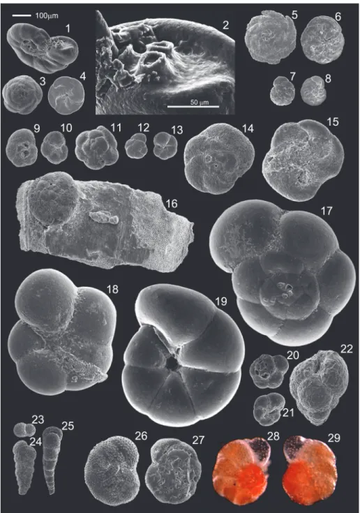 FIGURE 3. Scanning electron and light microscope micrographs of the foraminifera specimens
