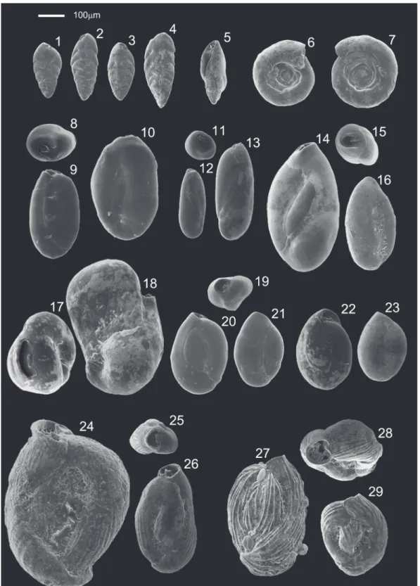 FIGURE 4.  Scanning electron micrographs of the foraminifera specimens. Scale bar equals 100 µm