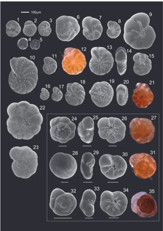 FIGURE 5. Scanning electron and light microscope micrographs of the foraminifera specimens