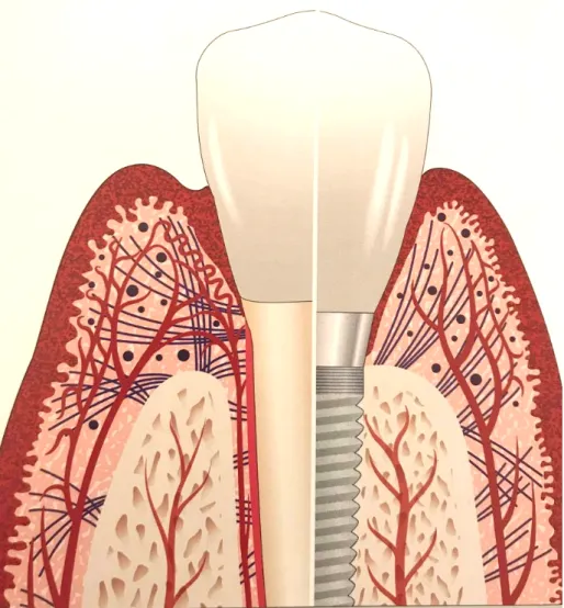Figura 2- Ilustração relativa à saúde dos tecidos ao redor do dente natural e do implante