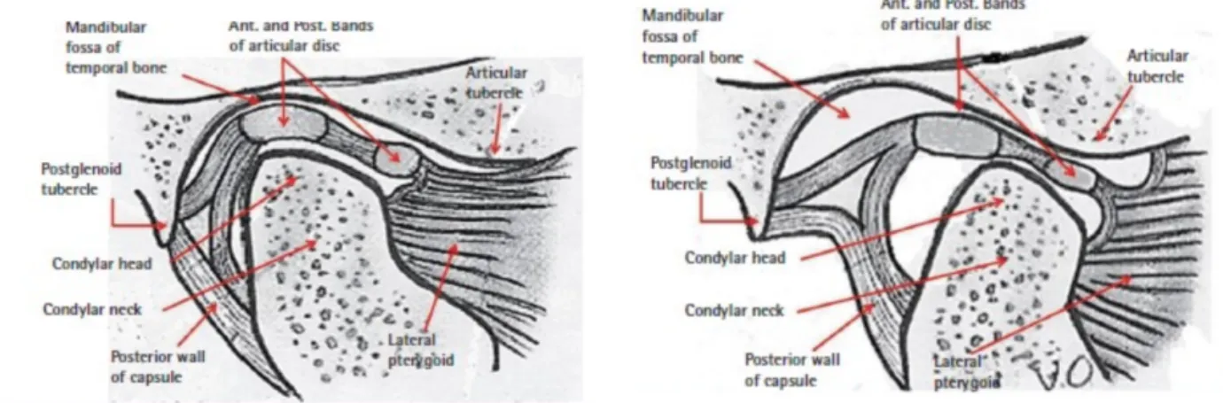 Figura 2 e 3 – Efeito da contração do músculo pterigoideu lateral no processo condilar (adaptado Choi et al., 2012)