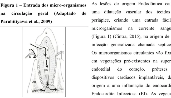 Figura 1 – Entrada dos micro-organismos  na  circulação  geral  (Adaptado  de  Parahitiyawa et al., 2009) 