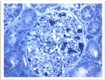 Figura I-9: Biópsia renal através de microscopia ótica (Adaptado de  17 ).  Aglomerado de  depósitos de globotriaosilceramida nos rins, com predominância nos podócitos (mancha azul  escuro) 17 