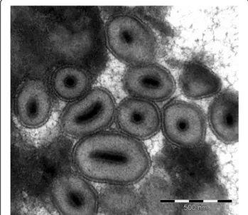Fig. 1 Ultrastructural analysis of Diatraea saccharalis granulovirus (DisaGV). Transmission electron micrograph reveals granular occlusion bodies containing singly embedded rod-shaped nucleocapsid (scale bars = 0.5 μ m)