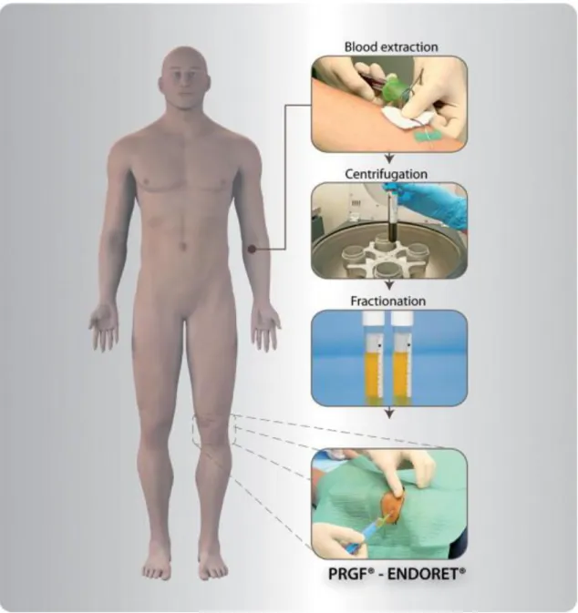 Figura 10: Esquema geral da obtenção de PRGF Endoret®. 