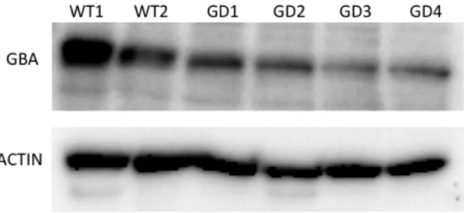 Figure    13    -­‐    Western    Blot    of    WT    and    GD    protein    samples