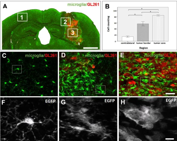 Figure 2. Analysis of microglial cells shows morphological changes depending on their location towards  the tumor tissue