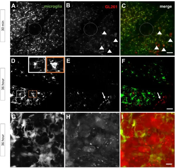 Figure  5.  Two-photon  laser-scanning  microscopy  (2P-LSM)  reveals  cellular  responses  of  microglia  to  tumor injections in vivo in TgH(CX3CR1-EGFP) mice