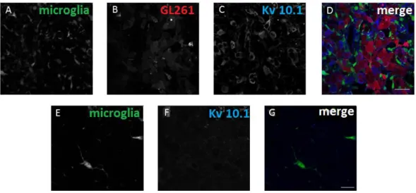 Figure  3.  Expression  of  Kv  10.1  in  TgH(CX3CR1-EGFP)  mice  orthotopically  injected  with  GL261mCherry glioma cells