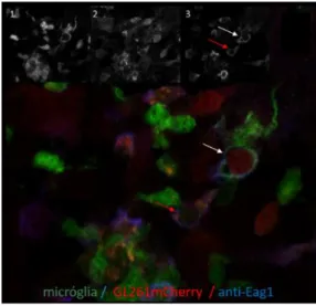 Figure  4.  Expression  of  Kv  10.1  in  TgH(CX3CR1-EGFP)  mice  orthotopically  injected  with  GL261mCherry  glioma  cells