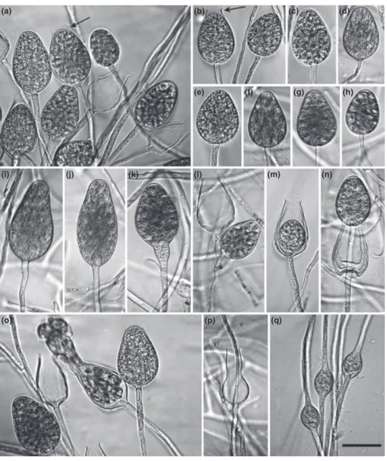 Figure 4 Morphological structures of Phytophthora lacustris formed on V8 agar flooded with non-sterile soil extract