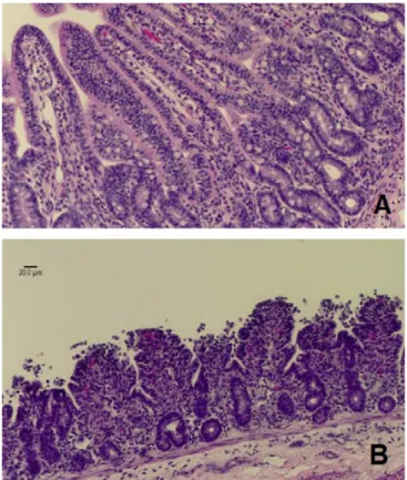 Figura 8. Mucosa do íleo de um vitelo saudável (A) e de um vitelo infetado por C. parvum  (B)  (adaptado de Foster &amp; Smith, 2009) 