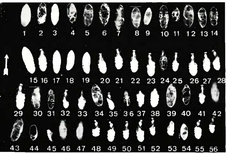 Fot. 1 — Radiografia de pupas não eclodidas de T. pityocampa, tirada em 30-X-1972