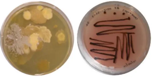 Figure 4- Agar plates. Left Mother plate; Right Bacteria isolate.