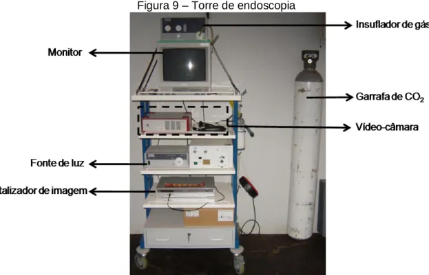 Figura 9 – Torre de endoscopia 