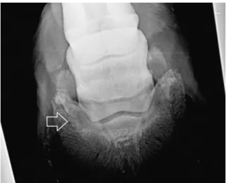 Figura  14–  Projecção  DPPDO  do  membro  torácico  esquerdo  com  ligeira  esclerose  na  inserção  do  lado  medial  (seta)