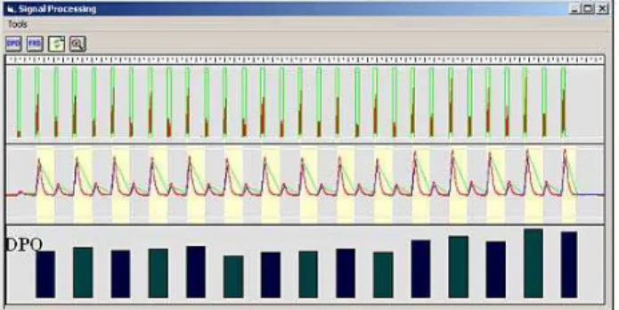Figure 15. Signal processing and DPO parameter calculation without  spark-out. 